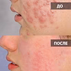 Катушки Мишина с генератором
