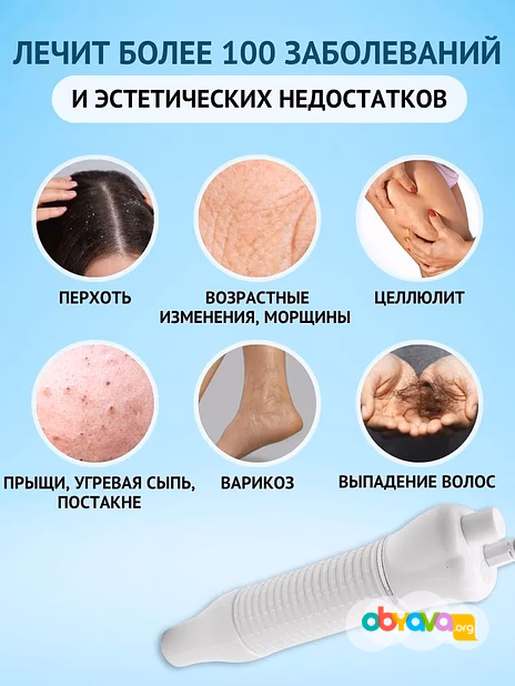 Дарсонваль