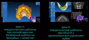 Учебный курс по хирургическим конструкциям в системе RealGuide